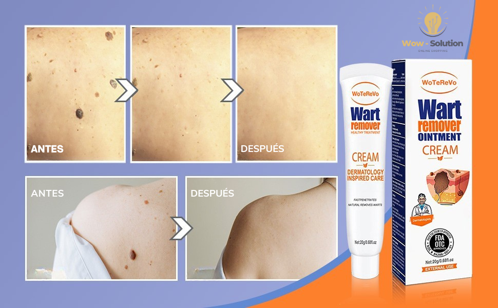 Crema Eliminadora de Verrugas ProDerm™