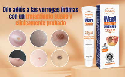 Crema Eliminadora de Verrugas ProDerm™
